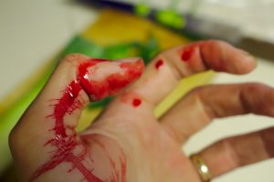 accident-743035-1-300x200.jpg