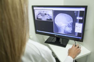 x-ray-of-the-jaw-2416945-300x200.jpg