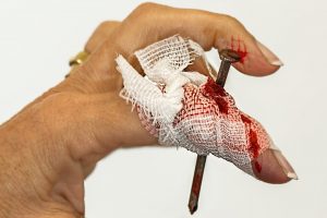 injury-903380-300x200.jpg