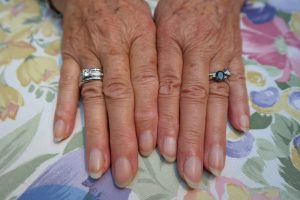 hands-195650_1920-300x200.jpg